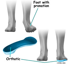 orthotics image