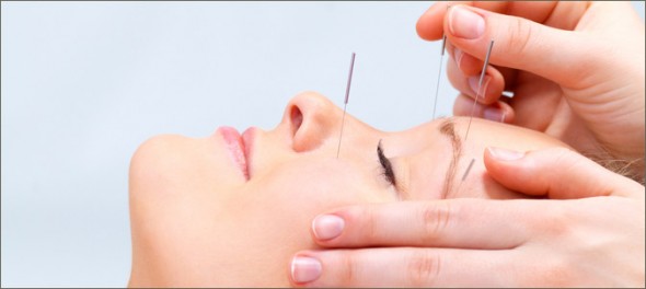 cosmetic acupuncture