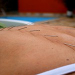 accupuncture chiropractic photo