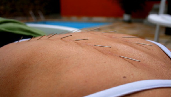 accupuncture chiropractic photo